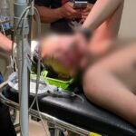 Polisi Belum Bisa Ungkap Pelaku Pengeroyokan Kader HMI Palopo